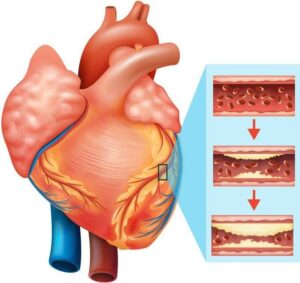 Thuốc Lào và Ảnh Hưởng Đến Tim Mạch